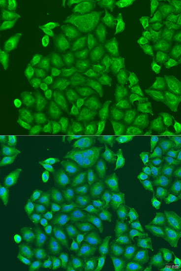 Immunofluorescence analysis of U2OS cells using CENPK Polyclonal Antibody at dilution of  1:100. Blue: DAPI for nuclear staining.