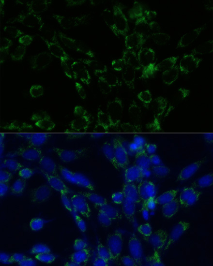 Immunofluorescence analysis of NIH-3T3 cells using GLUD1 Polyclonal Antibody at dilution of  1:100. Blue: DAPI for nuclear staining.