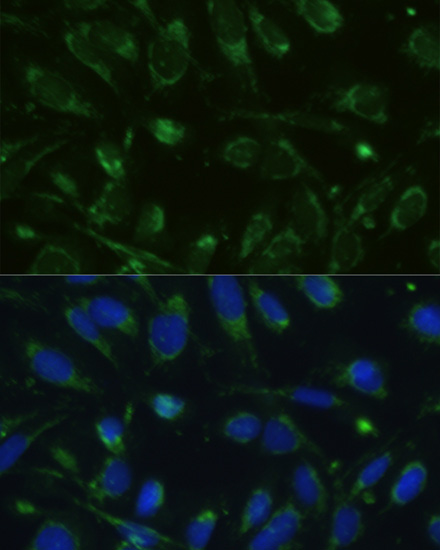 Immunofluorescence analysis of U-2 OS cells using GLUD1 Polyclonal Antibody at dilution of  1:100. Blue: DAPI for nuclear staining.
