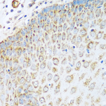 Immunohistochemistry of paraffin-embedded Human esophagus using GLUD1 Polyclonal Antibody at dilution of  1:100 (40x lens).