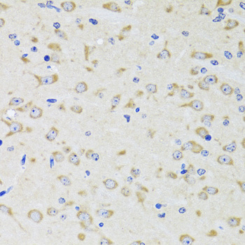 Immunohistochemistry of paraffin-embedded Rat brain using YWHAZ Polyclonal Antibody at dilution of  1:100 (40x lens).