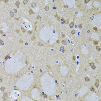 Immunohistochemistry of paraffin-embedded Mouse brain using YWHAZ Polyclonal Antibody at dilution of  1:100 (40x lens).