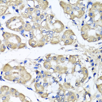 Immunohistochemistry of paraffin-embedded Human stomach using BCS1L Polyclonal Antibody at dilution of  1:100 (40x lens).