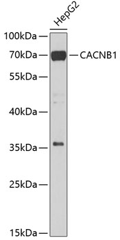 Western blot analysis of extracts of HepG2 cells using CACNB1 Polyclonal Antibody at dilution of 1:1000.