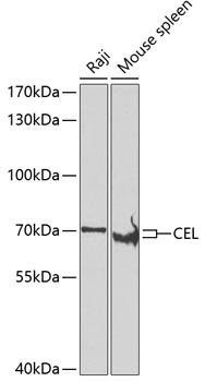Western blot analysis of extracts of various cell lines using CEL Polyclonal Antibody at dilution of 1:500.