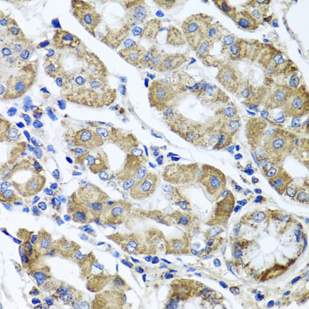 Immunohistochemistry of paraffin-embedded Human stomach using ETFA Polyclonal Antibody at dilution of  1:100 (40x lens).