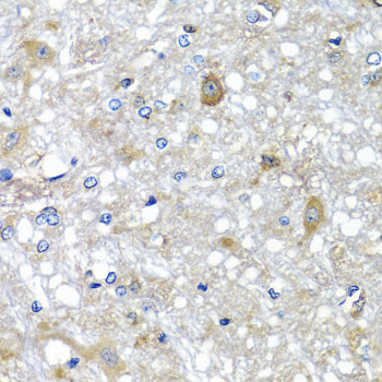 Immunohistochemistry of paraffin-embedded Rat brain using ETFA Polyclonal Antibody at dilution of  1:100 (40x lens).