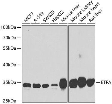 Western blot analysis of extracts of various cell lines using ETFA Polyclonal Antibody at dilution of 1:1000.