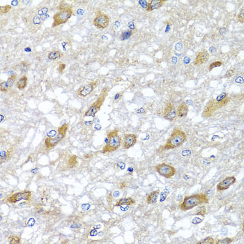 Immunohistochemistry of paraffin-embedded Rat brain using HSPA6 Polyclonal Antibody at dilution of  1:100 (40x lens).