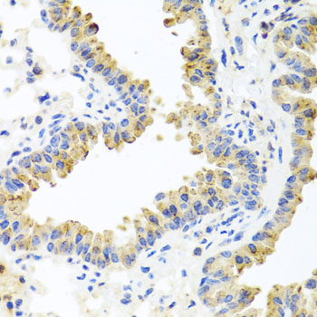 Immunohistochemistry of paraffin-embedded Mouse lung using HSPA6 Polyclonal Antibody at dilution of  1:100 (40x lens).