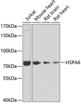 Western blot analysis of extracts of various cell lines using HSPA6 Polyclonal Antibody at dilution of 1:1000.