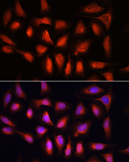 Immunofluorescence analysis of U-2 OS cells using IRF1 Polyclonal Antibody at dilution of  1:100. Blue: DAPI for nuclear staining.