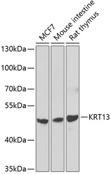 Western blot analysis of extracts of various cell lines using KRT13 Polyclonal Antibody at dilution of 1:1000.