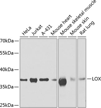 Western blot analysis of extracts of various cell lines using LOX Polyclonal Antibody at dilution of 1:500.