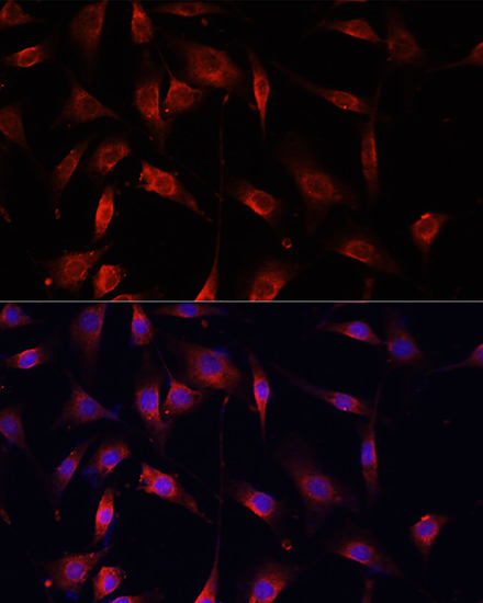 Immunofluorescence analysis of NIH/3T3 cells using SMAD2 Polyclonal Antibody at dilution of  1:100. Blue: DAPI for nuclear staining.