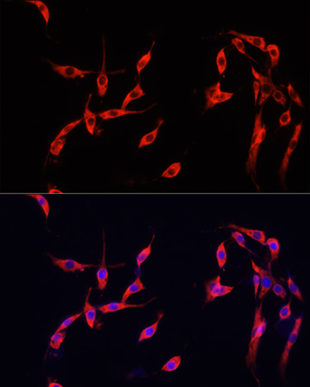 Immunofluorescence analysis of PC-12 cells using SMAD2 Polyclonal Antibody at dilution of  1:100. Blue: DAPI for nuclear staining.