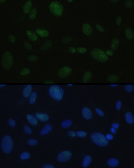 Immunofluorescence analysis of U-2OS cells using PRKDC Polyclonal Antibody at dilution of  1:100. Blue: DAPI for nuclear staining.