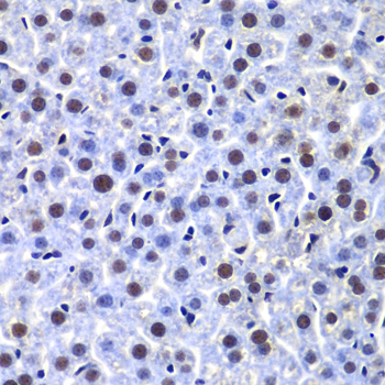 Immunohistochemistry of paraffin-embedded Mouse liver using PRKDC Polyclonal Antibody at dilution of  1:100 (40x lens).