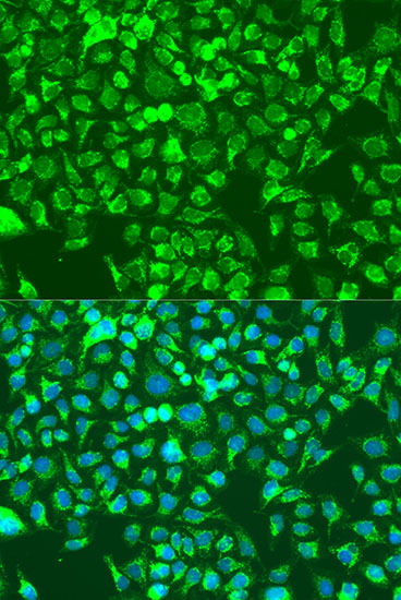 Immunofluorescence analysis of U2OS cells using SHC1 Polyclonal Antibody at dilution of  1:100. Blue: DAPI for nuclear staining.