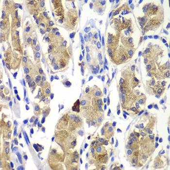 Immunohistochemistry of paraffin-embedded Human stomach using SHC1 Polyclonal Antibody at dilution of  1:100 (40x lens).