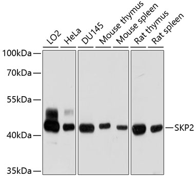 Western blot analysis of extracts of various cell lines using SKP2 Polyclonal Antibody at dilution of 1:1000.