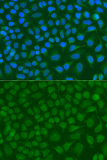 Immunofluorescence analysis of A549 cells using SSX5 Polyclonal Antibody