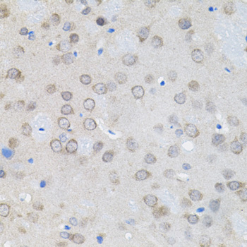 Immunohistochemistry of paraffin-embedded Rat brain using UBE2A Polyclonal Antibody