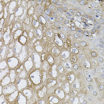 Immunohistochemistry of paraffin-embedded Human esophagus using UBE2A Polyclonal Antibody