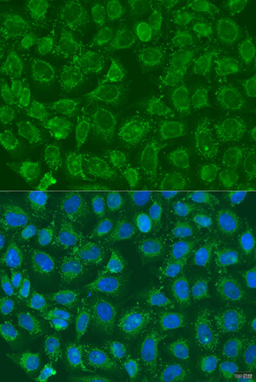 Immunofluorescence analysis of U2OS cells using PIP5K1B Polyclonal Antibody at dilution of  1:100. Blue: DAPI for nuclear staining.