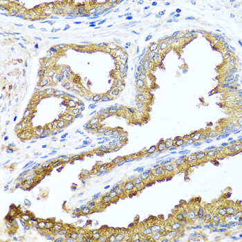 Immunohistochemistry of paraffin-embedded Human prostate using NCK2 Polyclonal Antibody at dilution of  1:100 (40x lens).