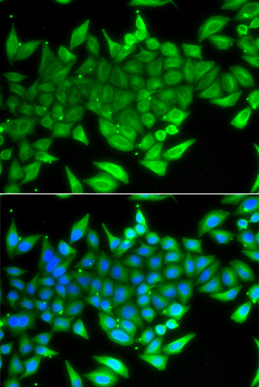 Immunofluorescence analysis of A549 cells using TTF2 Polyclonal Antibody