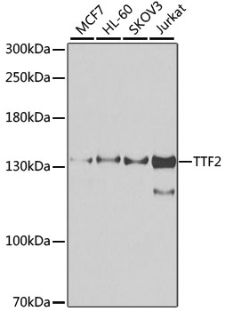 Western blot analysis of extracts of various cell lines using TTF2 Polyclonal Antibody at dilution of 1:1000.