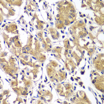 Immunohistochemistry of paraffin-embedded Human gastric using DGKE Polyclonal Antibody at dilution of  1:100 (40x lens).