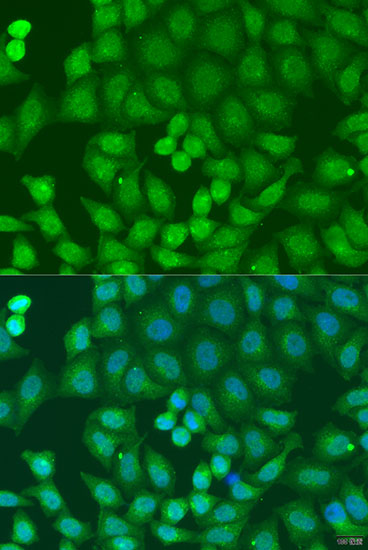 Immunofluorescence analysis of U2OS cells using ZFYVE16 Polyclonal Antibody at dilution of  1:100. Blue: DAPI for nuclear staining.