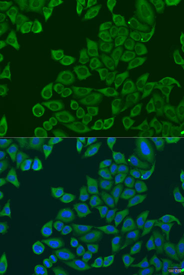 Immunofluorescence analysis of U2OS cells using RPL36 Polyclonal Antibody at dilution of  1:100. Blue: DAPI for nuclear staining.