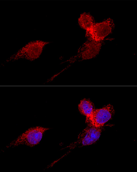 Confocal immunofluorescence analysis of HeLa cells using RPL36 Polyclonal Antibody at dilution of  1:200. Blue: DAPI for nuclear staining.