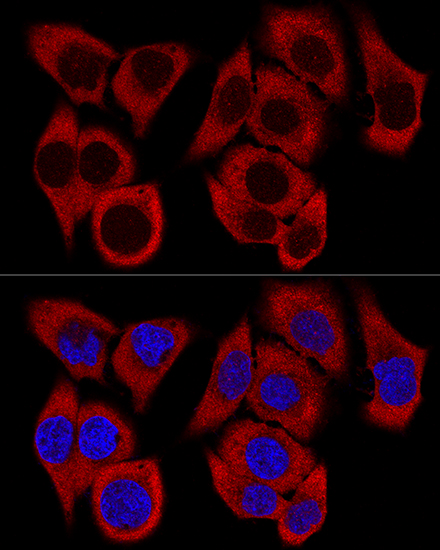 Confocal immunofluorescence analysis of HeLa cells using RPL36 Polyclonal Antibody at dilution of  1:200. Blue: DAPI for nuclear staining.