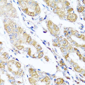 Immunohistochemistry of paraffin-embedded Human stomach using DARS2 Polyclonal Antibody at dilution of  1:100 (40x lens).