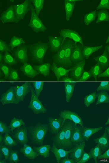 Immunofluorescence analysis of U2OS cells using PRMT6 Polyclonal Antibody at dilution of  1:100. Blue: DAPI for nuclear staining.