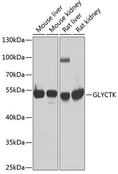 Western blot analysis of extracts of various cell lines using GLYCTK Polyclonal Antibody at dilution of 1:1000.