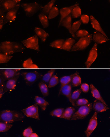 Immunofluorescence analysis of HeLa cells using ACVR2B Polyclonal Antibody at dilution of  1:100 (40x lens). Blue: DAPI for nuclear staining.