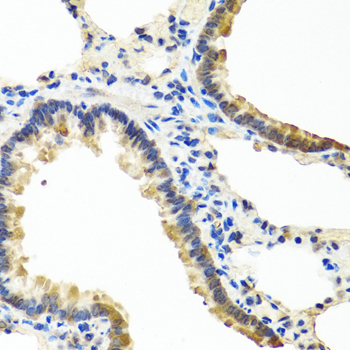 Immunohistochemistry of paraffin-embedded Rat lung using ANGPT1 Polyclonal Antibody at dilution of  1:100 (40x lens).