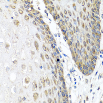 Immunohistochemistry of paraffin-embedded Human esophagus using ANGPT1 Polyclonal Antibody at dilution of  1:100 (40x lens).