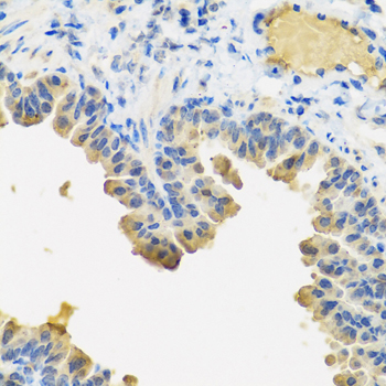 Immunohistochemistry of paraffin-embedded Mouse lung using ANGPT1 Polyclonal Antibody at dilution of  1:100 (40x lens).