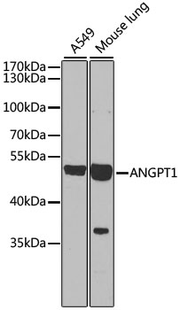Western blot analysis of extracts of various cell lines using ANGPT1 Polyclonal Antibody at dilution of 1:1000.
