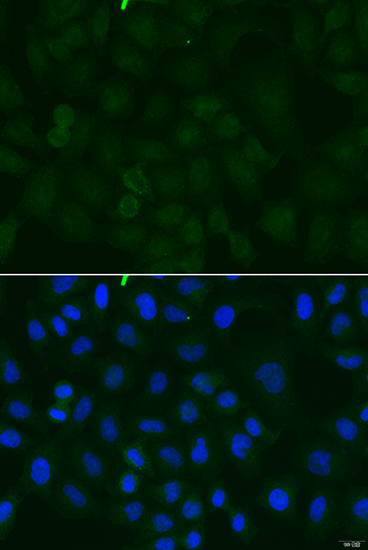 Immunofluorescence analysis of U2OS cells using ATP1A1 Polyclonal Antibody at dilution of  1:100. Blue: DAPI for nuclear staining.