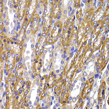 Immunohistochemistry of paraffin-embedded Rat kidney using ATP1A1 Polyclonal Antibody at dilution of  1:100 (40x lens).