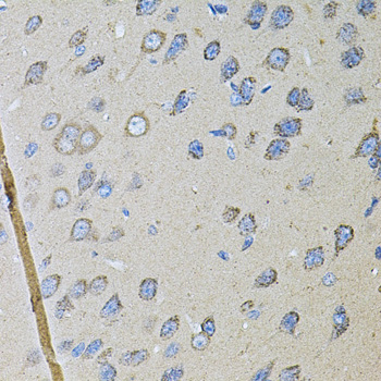 Immunohistochemistry of paraffin-embedded Rat brain using CDH16 Polyclonal Antibody at dilution of  1:100 (40x lens).