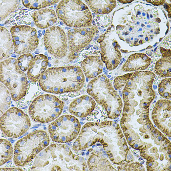 Immunohistochemistry of paraffin-embedded Rat kidney using CDH16 Polyclonal Antibody at dilution of  1:100 (40x lens).