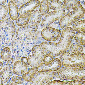 Immunohistochemistry of paraffin-embedded Mouse kidney using CDH16 Polyclonal Antibody at dilution of  1:100 (40x lens).